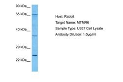 MTMR6 Antibody, Novus Biologicals 100 &mu;L | Buy Online | Novus Biologicals | Fisher Scientific